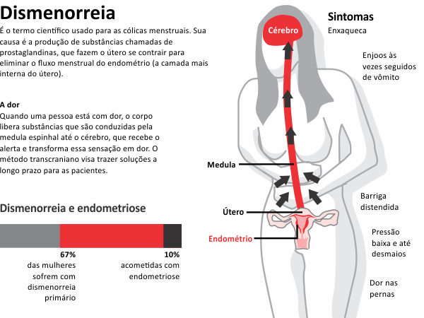 Cólicas menstruais e dismenorreia causas e tratamento